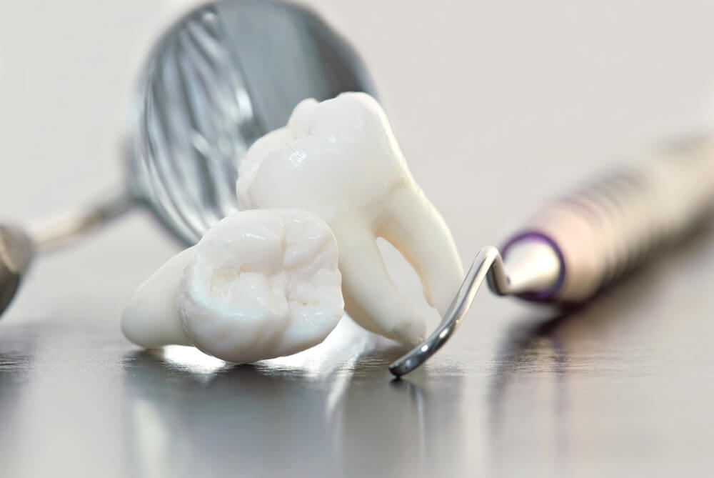 Удалить зуб последствие. Фоновое изображение для стоматологии.